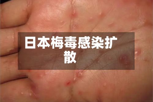 日本梅毒感染扩散